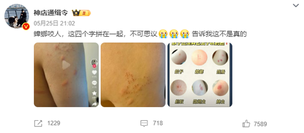“蟑螂咬人”上热搜 《博物杂志》分析辟谣:三种可能
